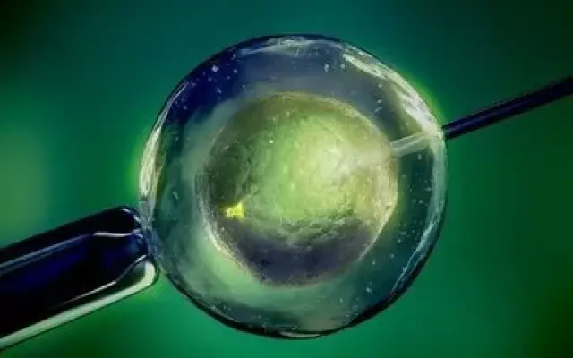 染色体易位
